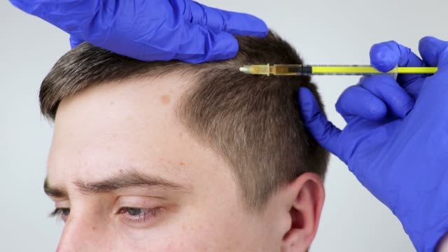 Hair Transplant Istanbul – Experts in Hair Growth and Restoration
